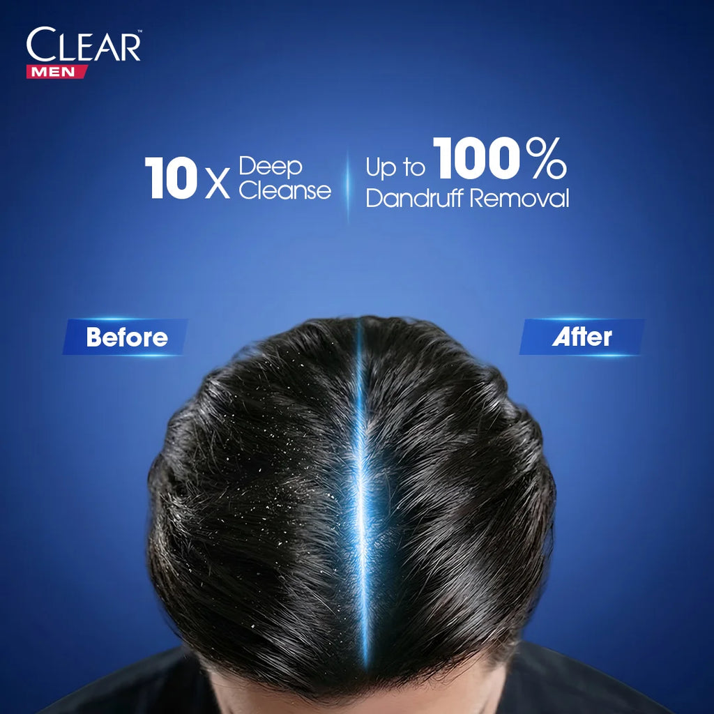 Clear Men Deep Cleanse Anti Dandruff Shampoo - 185ml