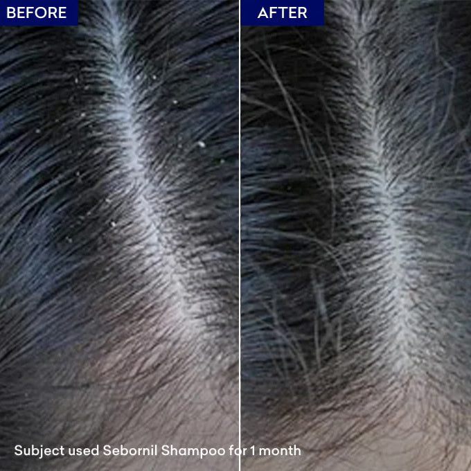 Jenpharm Sebornil Shampoo