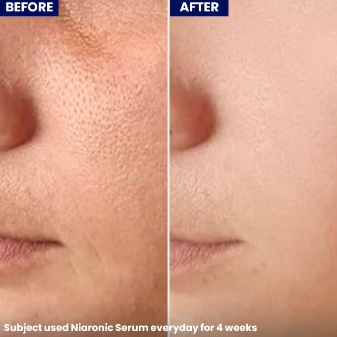 Jenpharm NiaRonic Serum (Pore Minimizing)