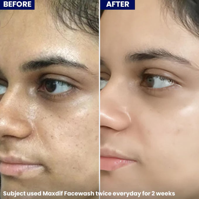 Jenpharm Maxdif Facewash