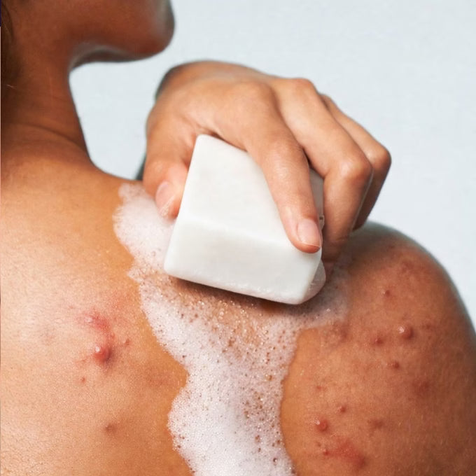 Jenpharm Clarevo Anti Acne Soap