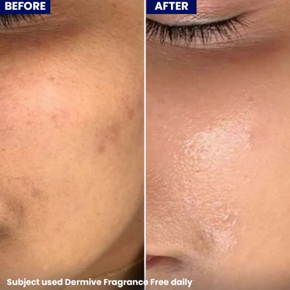 Jenpharm Dermive Oil-Free Fragrance Free Moisturizer