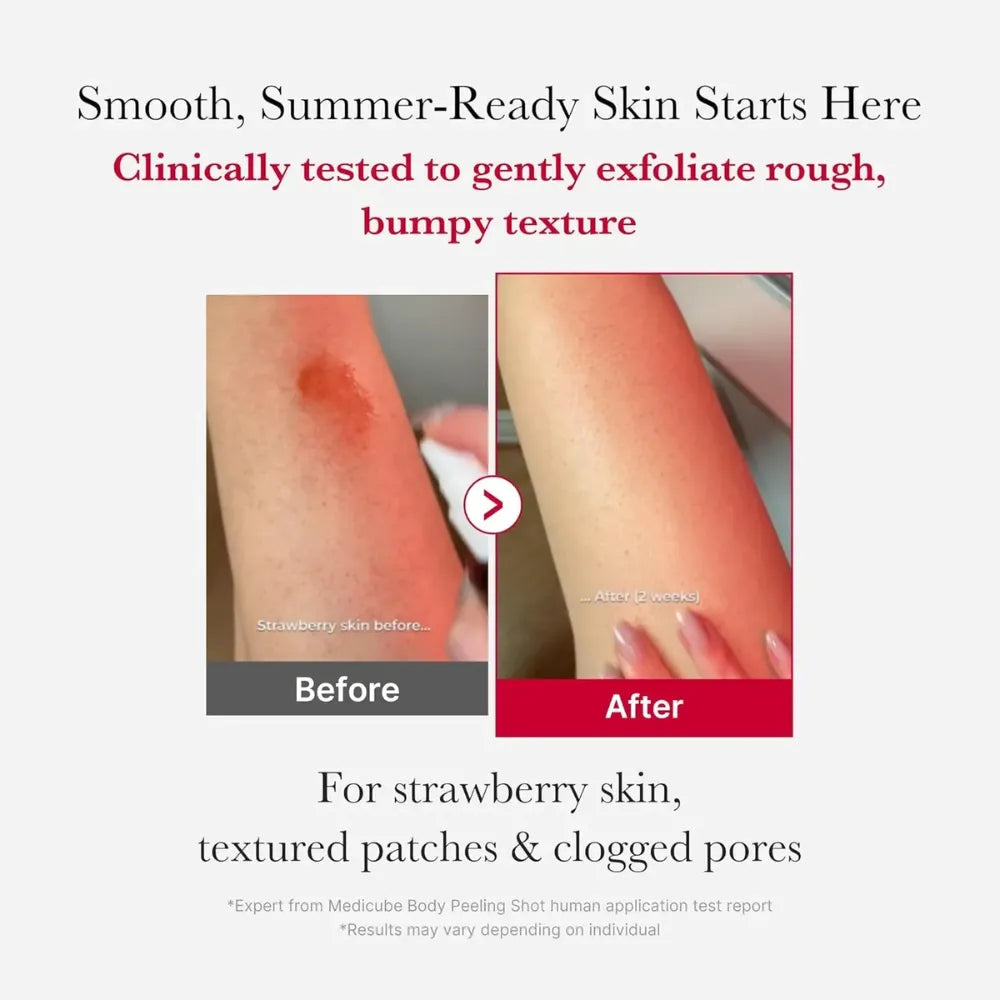 Medicube Red Acne Body Peeling Shot Toner - 110g