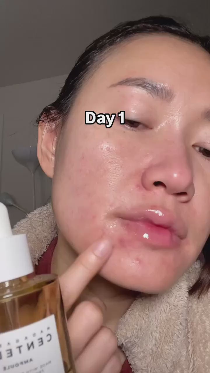 Skin1004 Madagascar Centella Ampoule